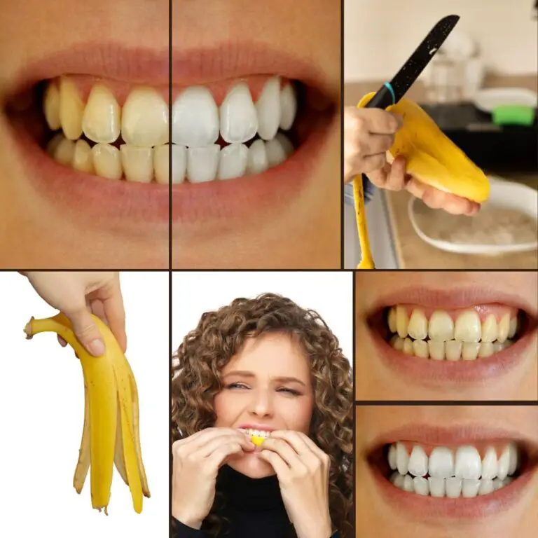 Secret That Dentists Don’t Want You to Know: Remove Tartar and Teeth Whitening in Just 2 Minutes 🪥🦷