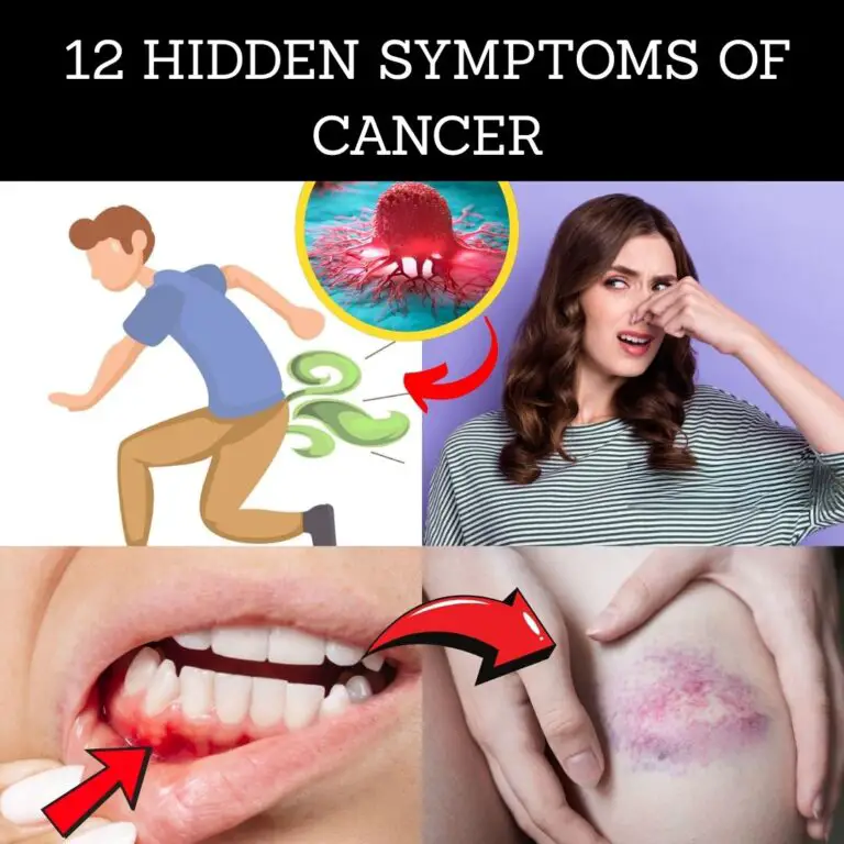 12 Early Cancer Signs You Can’t Ignore – Your Body Is Trying to Tell You Something