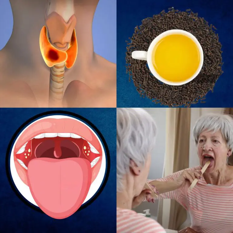 The Natural Antibiotic That Soothes Sore Throat and Inflammation